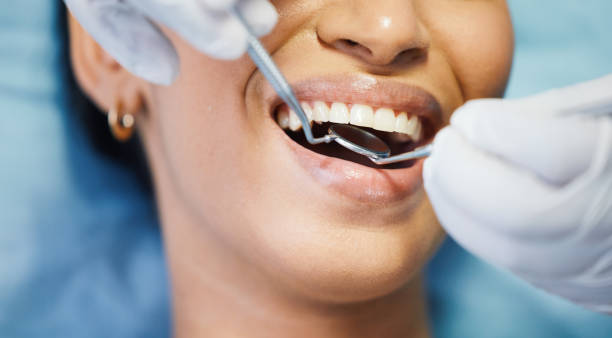 Best Emergency Denture Repair in Layhill, MD